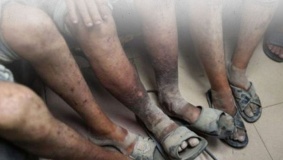 معتقلو غزة في "عوفر والنقب" يتعرضون لتعذيب ويواجهون مرض الجرب