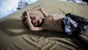 للمرة الأولى.. الأمم المتحدة تعلن رسمياً عن مجاعة في غزة
