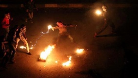 إصابات في مناطق متفرقة من القدس