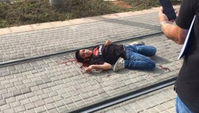 تحسن على صحة الطفل الجريح أحمد مناصرة