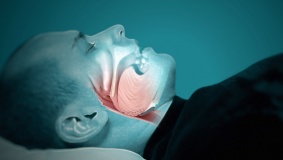 انقطاع النفس أثناء النوم يؤثر سلبا على القلب وسكر الدم