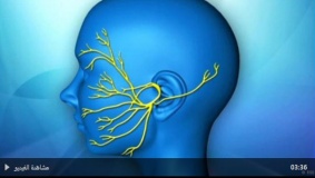 شلل الوجه ..المسببات والعلاج