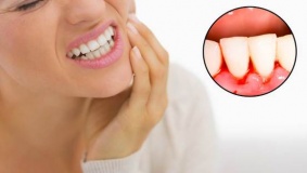 خروج الدم من الفم.. أسبابه ونصائح لعلاجه