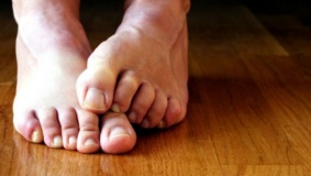 3 خطوات لعلاج فطريات القدم