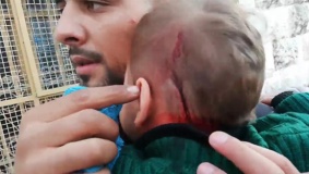 إصابة عدد من المواطنين في اعتداء للمستوطنين وسط الخليل