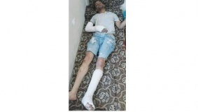 جنود الاحتلال يعتدون على عامل من جنين
