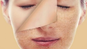 لماذا تظهر القشور على الجلد ؟