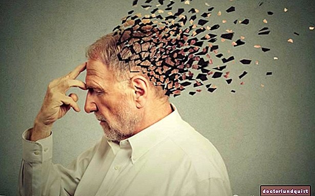 الغذاء الأكثر فعالية في تقليل الإصابة بالخرف