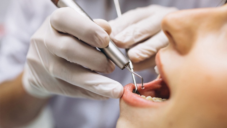 الأردن.. ضبط 21 شخصاً يمارسون طب الأسنان بلا شهادة