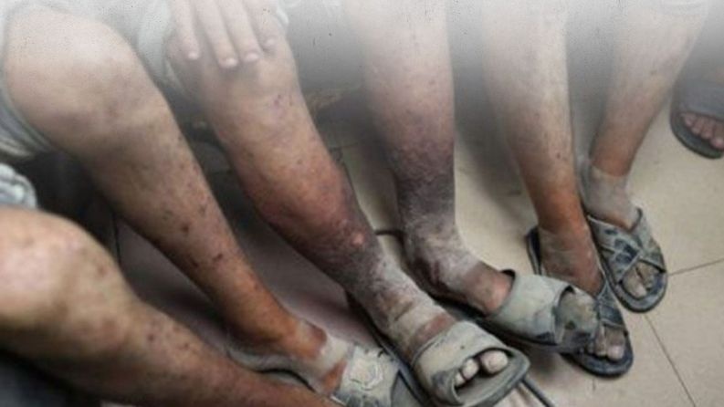 معتقلو غزة في "عوفر والنقب" يتعرضون لتعذيب ويواجهون مرض الجرب