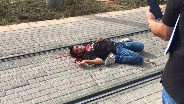 تحسن على صحة الطفل الجريح أحمد مناصرة