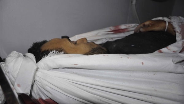 استشهاد شاب متأثرا بجروحه خلال العدوان على غزة