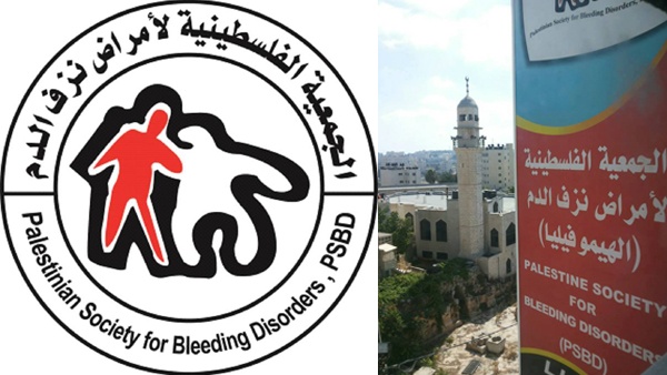 بدعم من "جمعية الهيموفيليا" ..."الصحة" تجري عمليات تغيير مفاصل تالفة لمرضى "هيموفيليا"