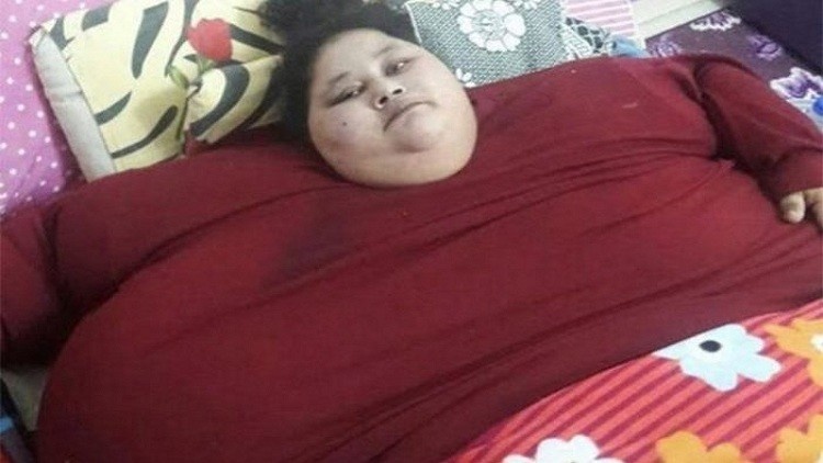 المصرية الأسمن في العالم تفقد 40 كلغ من وزنها في أسبوع