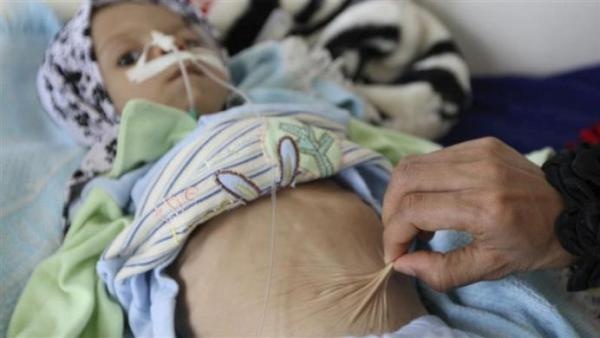 مؤسسات أممية: انعدام الأمن الغذائي يهدد 17 مليون يمني