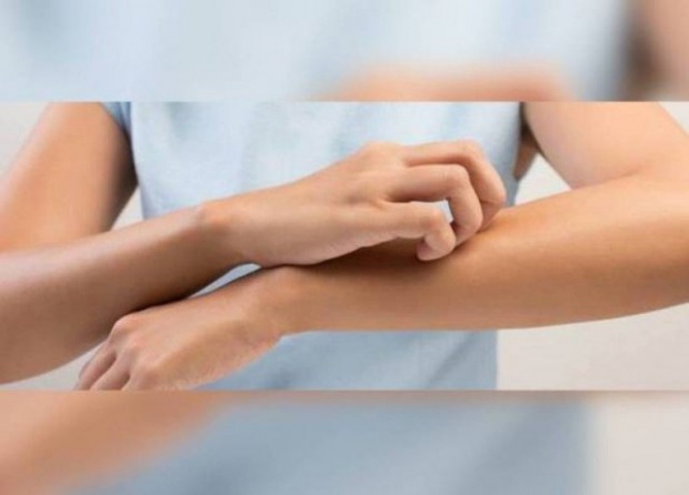 هل تحك جلدك عند مشاهدتك لشخص آخر يقوم بذلك؟