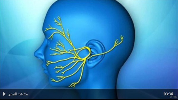 شلل الوجه ..المسببات والعلاج