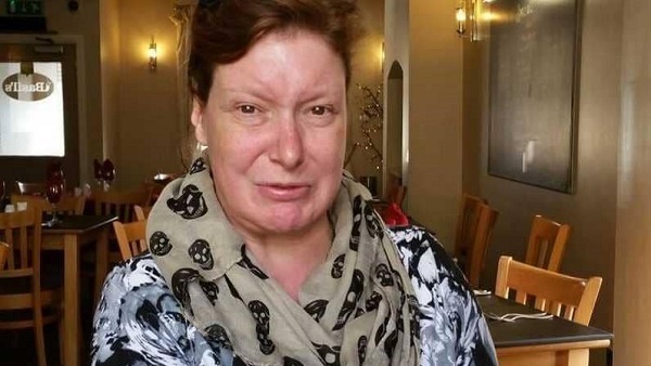 بريطانية لم تبتسم منذ أكثر من 30 عاماً