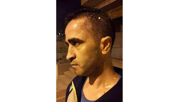 الخليل: مستوطنون يرشون مواطنا وزوجته بغاز الفلفل