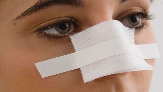 تقنية مذهلة لتجميل الأنف خلال 5 دقائق!