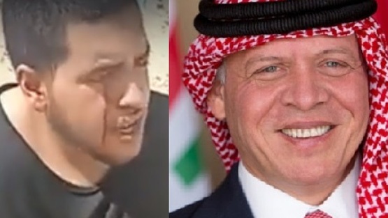 الملك يوجه بتوفير العلاج اللازم لفتى الزرقاء