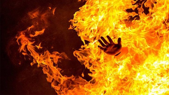في الاردن.. شخص يحرق زوجته حتى الموت