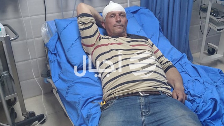 مستوطنون يعتدون على مواطن شمال غرب رام الله